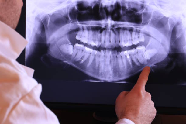 Best Dentist for Severe Toothache  in Altamont, TN