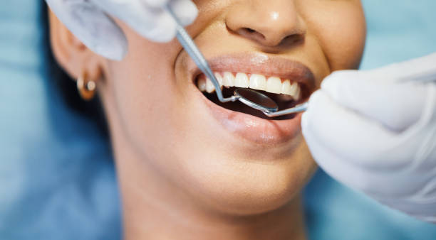 Best Knocked-Out Tooth Emergency  in Altamont, TN