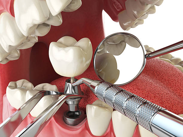 Best Emergency Tooth Extraction  in Altamont, TN